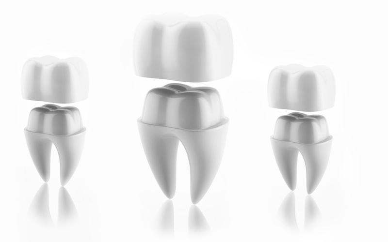 Smile Esthetics Stomatoloska ordinacija Beograd