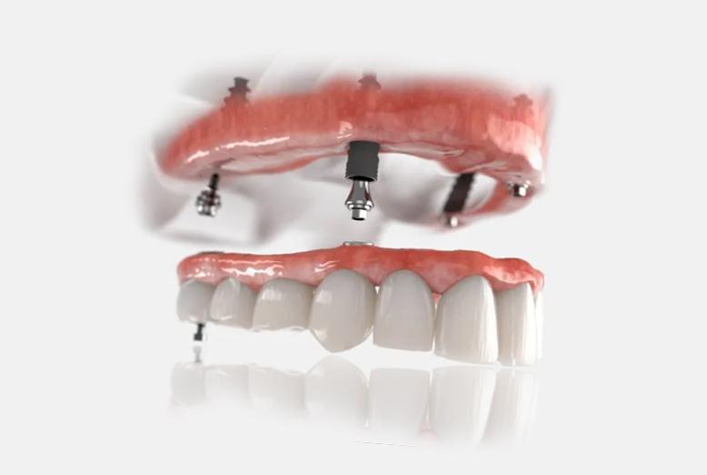 Smile Esthetics Stomatoloska ordinacija Beograd